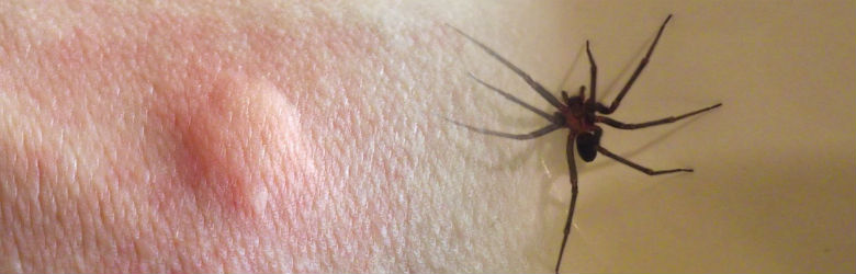 Mordedura por araña de rincón - IPSUSS