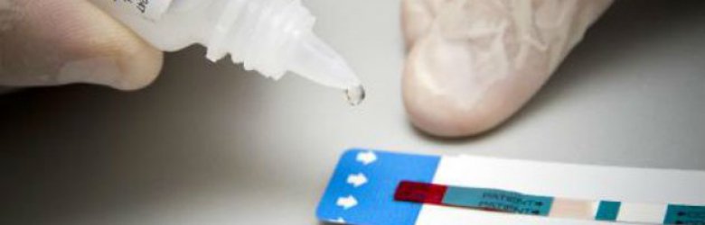 Prevención del VIH: ¿Cómo funciona el test rápido y cuáles son sus ventajas?