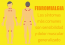 ¿Qué es la fibromialgia?