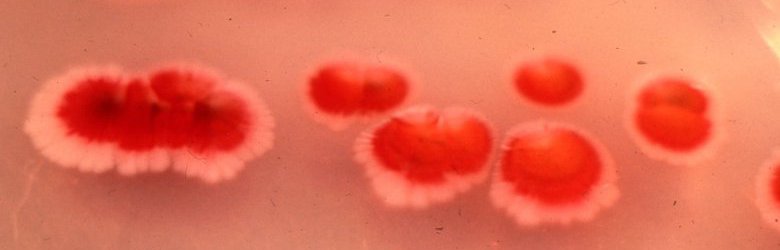 ISP ordena el retiro de antiséptico contaminado con bacteria de recintos hospitalarios y farmacias