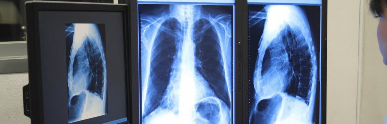 Estudio alerta sobre el riesgo de exceso de exámenes radiológicos
