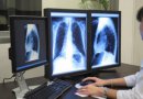 Estudio alerta sobre el riesgo de exceso de exámenes radiológicos