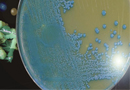 Este semestre Chile tendría Plan Nacional para combatir resistencia bacteriana