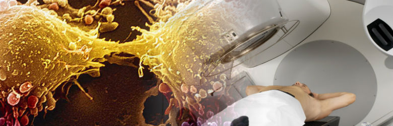 La importancia de los cuidados continuos en el cáncer La importancia de los cuidados continuos en el cáncer