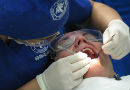 Pérdida de dientes: la clave es la prevención