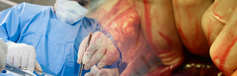 OMS establece 29 directrices de detener las infecciones quirúrgicas