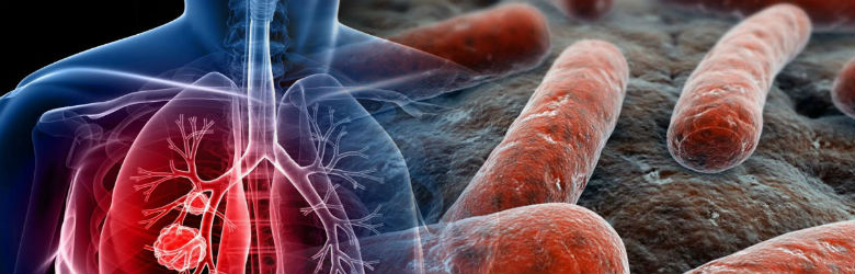 Día Mundial de la Tuberculosis: la enfermedad infecciosa más letal a nivel mundial