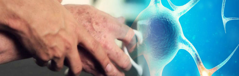 Enfermedad de parkinson y tratamiento Enfermedad de parkinson y tratamiento