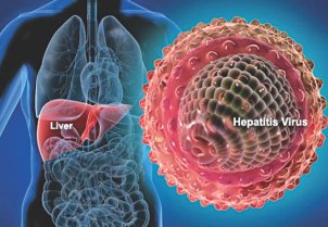 Hepatitis: transmisión y prevención