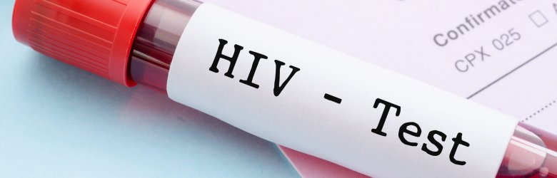 VIH bajo la lupa