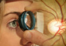 Glaucoma: la enfermedad silenciosa