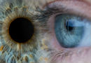 Glaucoma, la importancia de la detección precoz