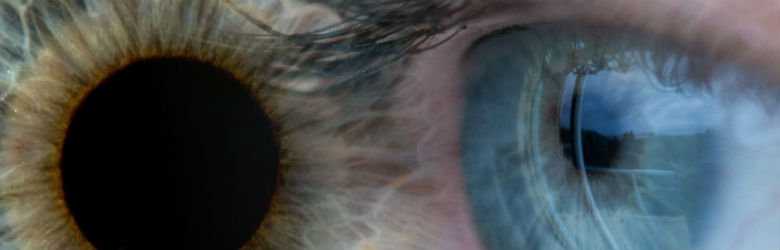 Glaucoma, la importancia de la detección precoz Glaucoma, la importancia de la detección precoz
