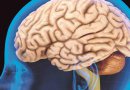 Identifican un nuevo tipo de demencia que se confundía con Alzheimer