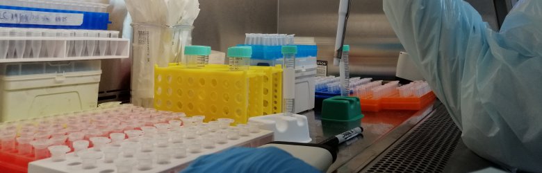 ¿En qué consiste la batalla microscópica contra en COVID-19?