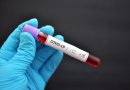 Chile registra más de 2 millones de casos de COVID-19 desde el inicio de la pandemia